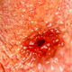 Illustration for article titled Nation’s Stomach Ulcers Predict Trump Administration Will Provide Opportunities For Unlimited Growth In 2017